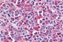 Bestrophin 2 Antibody, Novus Biologicals 50 &mu;g; Unconjugated:Antibodies,